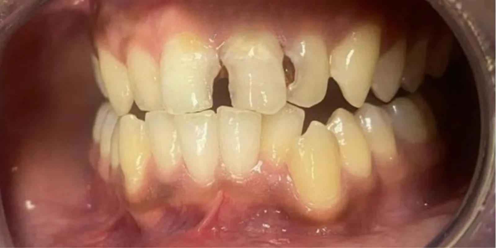 Before dental treatment