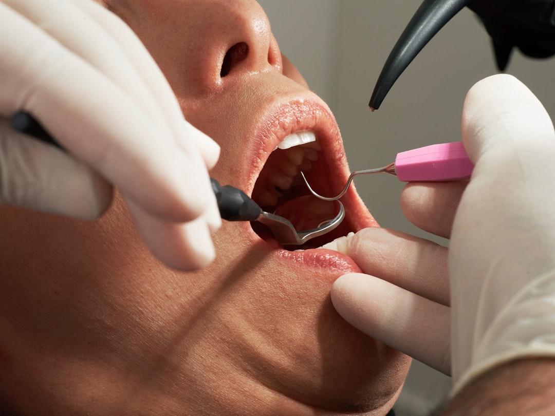 Professional dental scaling and polishing