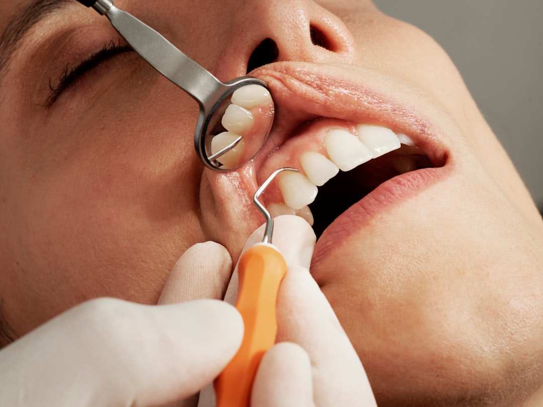 Close-up of a dental examination using a mirror and probe